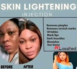 Skin Lightening And Whitening Creams and Pills in Rustenburg+27 81 850 2816 